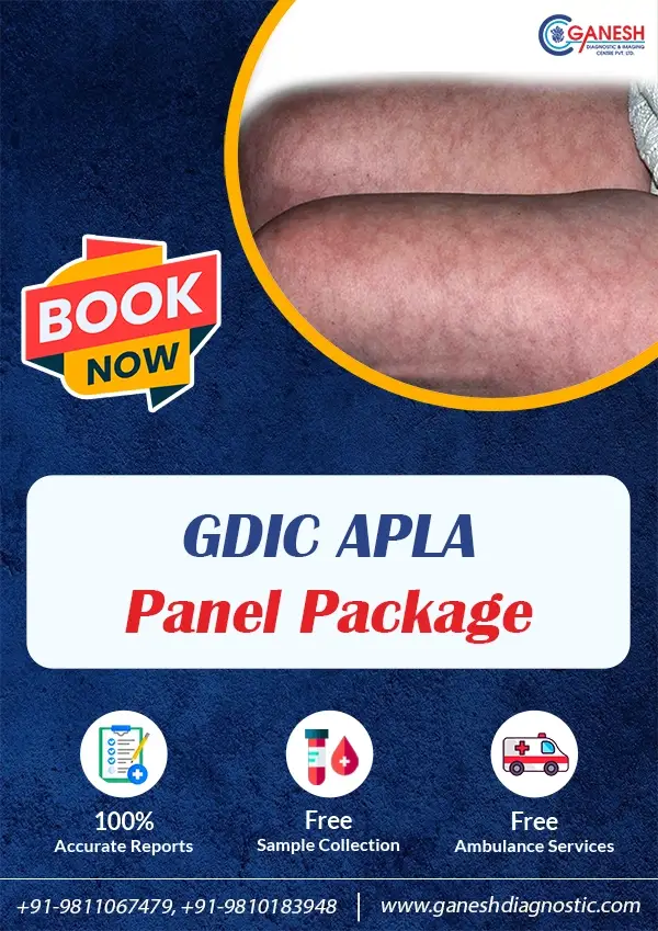GDIC APLA Panel Package
